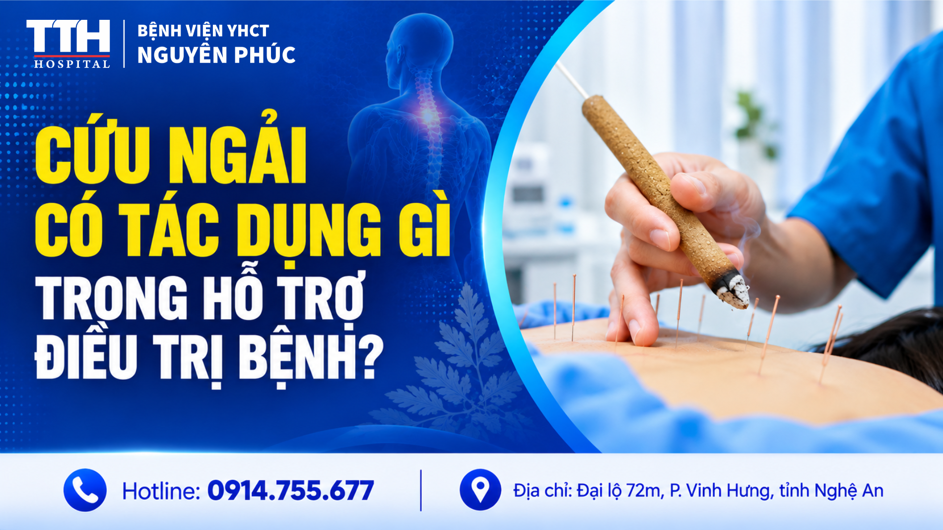 CỨU NGẢI CÓ TÁC DỤNG GÌ TRONG HỖ TRỢ ĐIỀU TRỊ BỆNH?